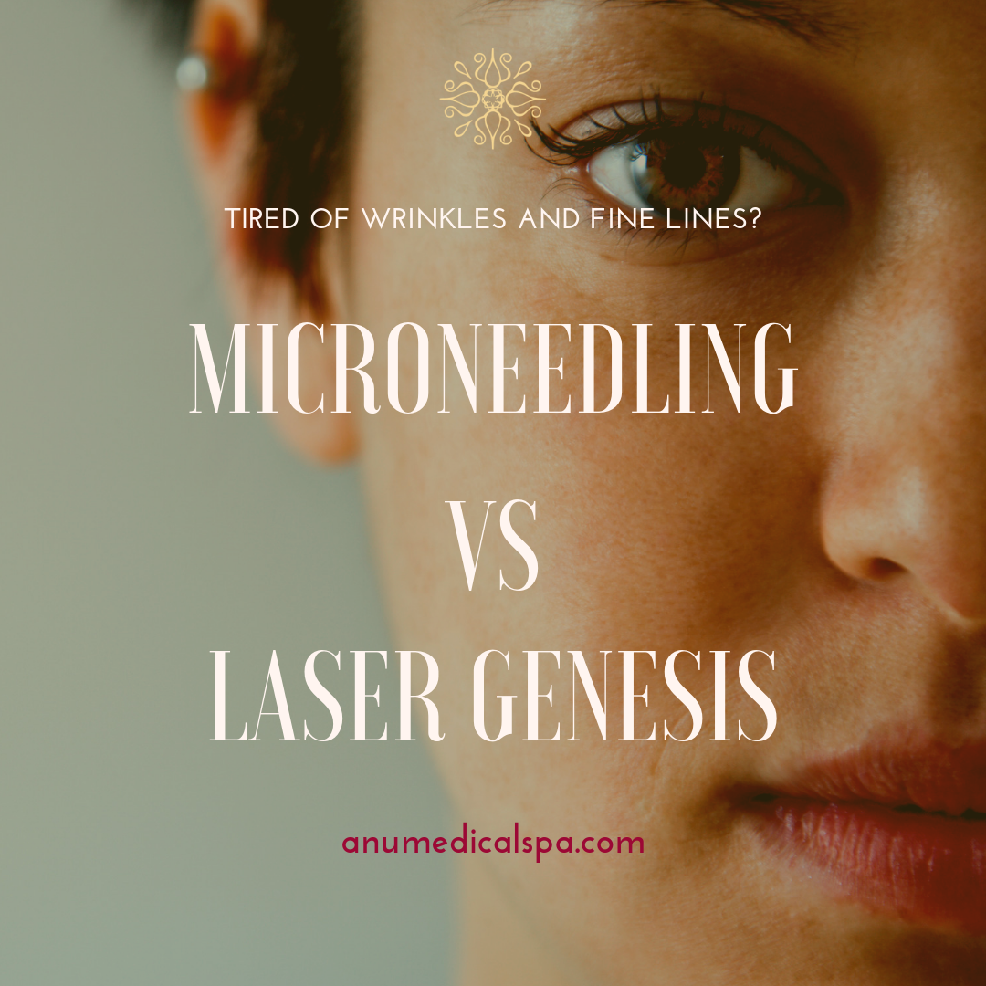 microneedling vs laser genesis