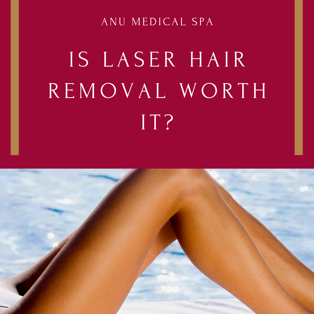 is laser hair removal worth it blog title