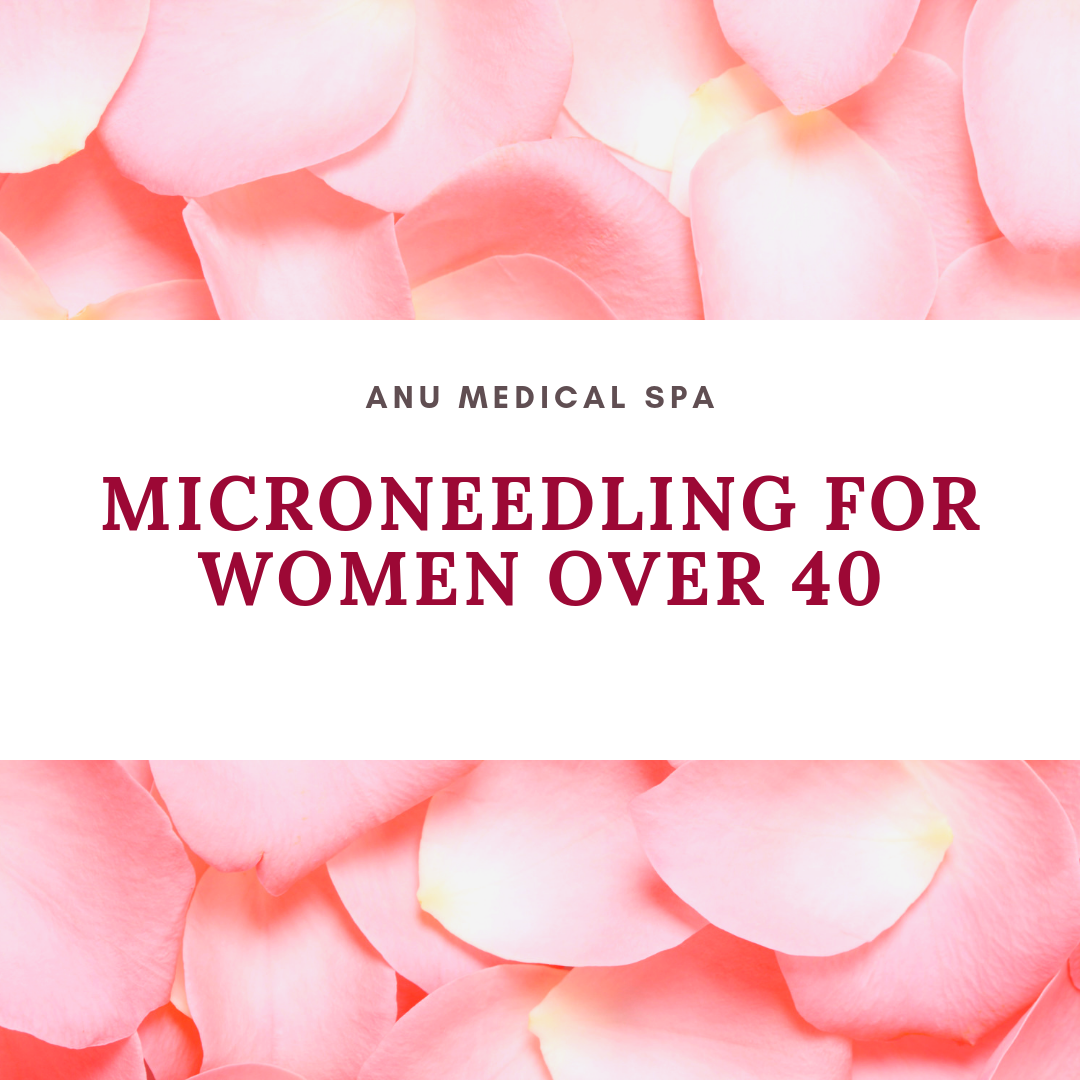 microneedling for women over 40
