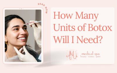 How Many Units of Botox Will I Need?