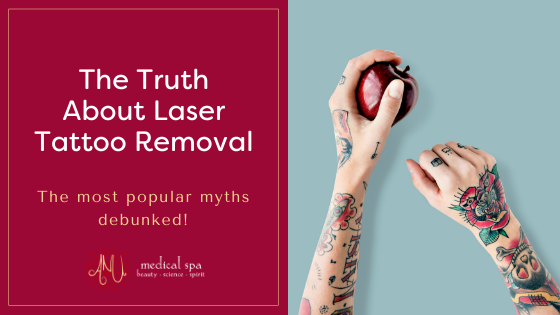 5 Myths About Laser Tattoo Removal