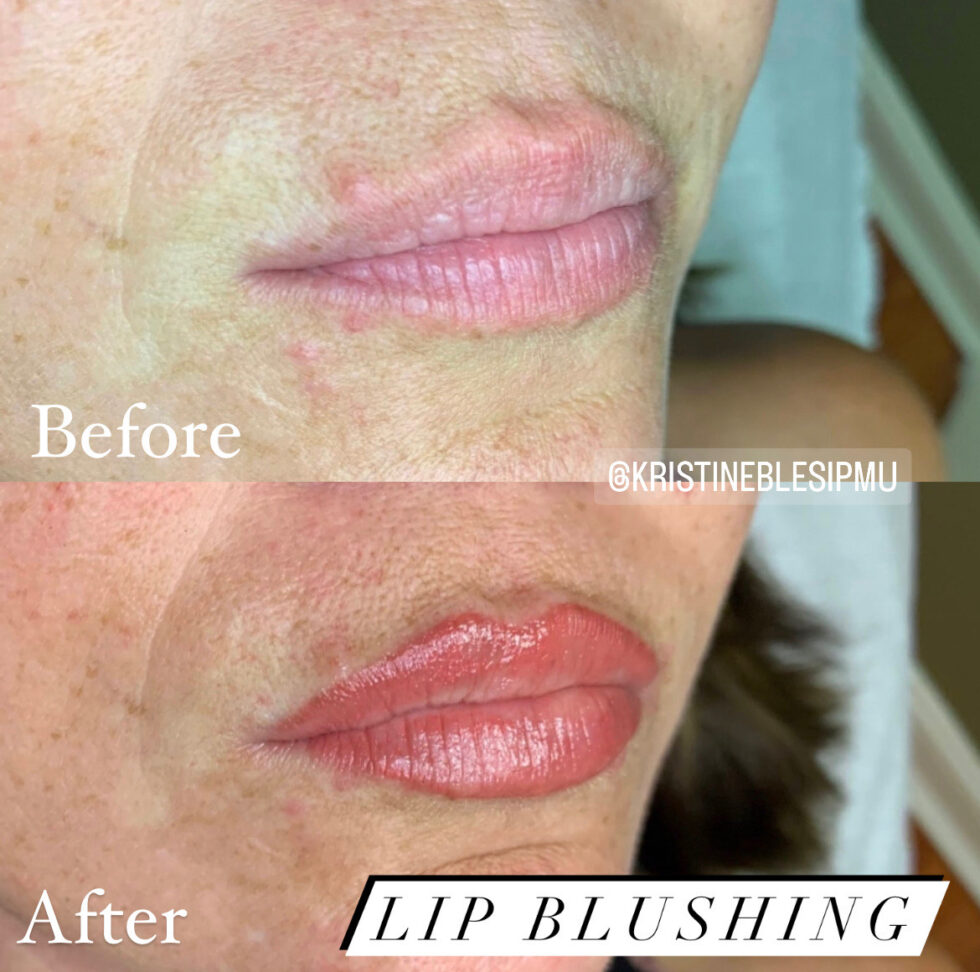 Lip Blushing - Anu Medical Spa