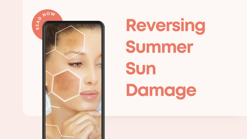 Reversing Summer Sun Damage - Anu Medical Spa