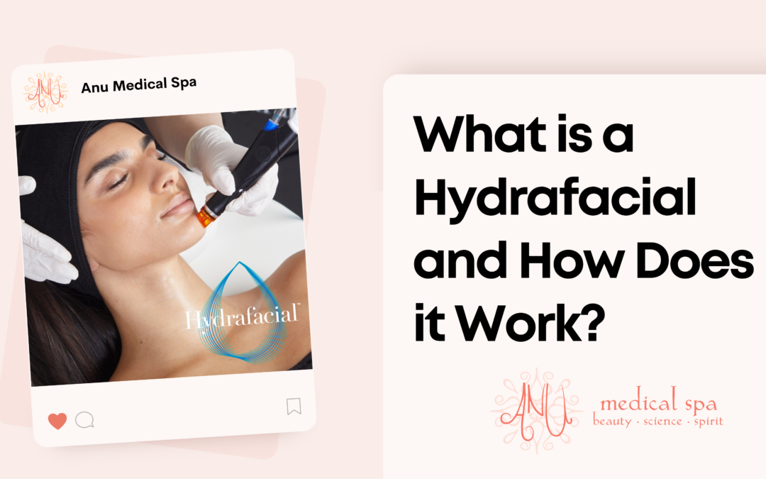 What is a Hydrafacial and How Does it Work?