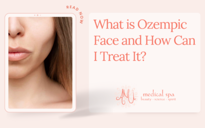 What is Ozempic Face and How Can I Treat It?