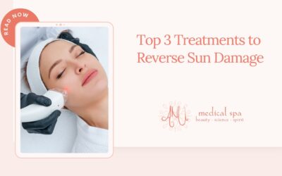 Top 3 Treatments to Reverse Sun Damage