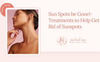 Sun Spots be Gone!- Treatments to Help Get Rid of Sunspots