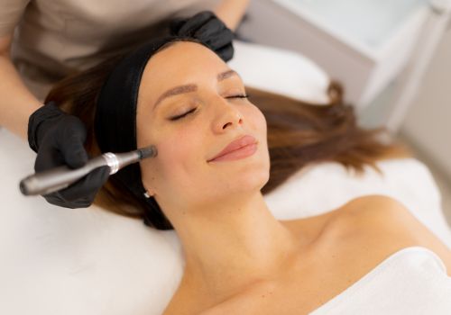 Microneedling