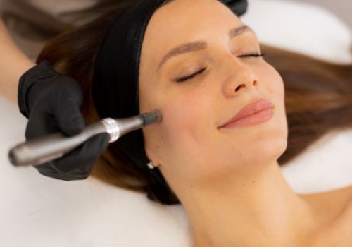 Microneedling  Full Face & Neck