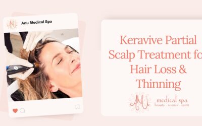 Keravive Scalp Treatment for Hair Loss & Thinning