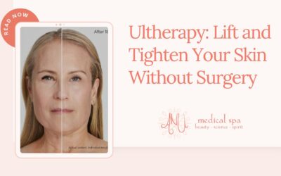 Ultherapy: Lift and Tighten Your Skin Without Surgery