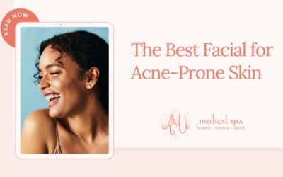 The Best Facial for Acne-Prone Skin