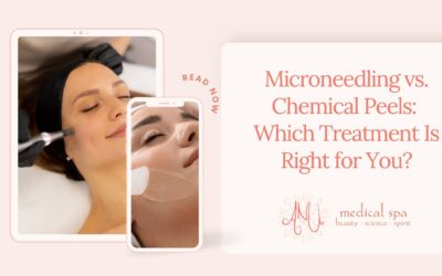 Microneedling vs. Chemical Peels: Which Treatment Is Right for You?